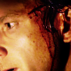 very_loyal: (john is injured 2)
