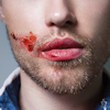 seekingvinland: (PB short - bloody lips)