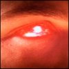 xp_cyclops: (Scott smash!)