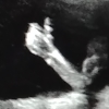 crystalpyramid: ultrasound image of a tiny hand doing a thumbs-up (hexagon, thumbs)