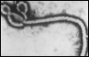 etumukutenyak: (Ebola virus)