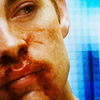 chasedthestars: (Bloodied.)
