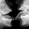 foxfirefey: An x-ray of two skulls licking each other. (skull lick)