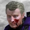 brodakota: (no helmet; injured)