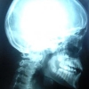 phinnia: it's a brain. in a skull. (brain)