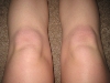 angelak: (Knees)